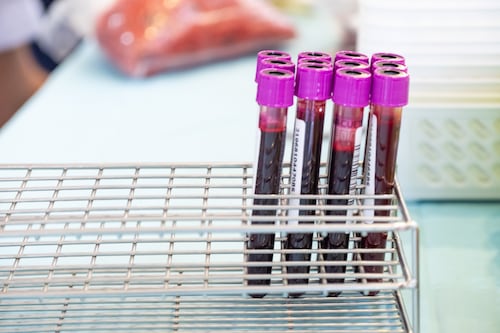 Portland-Area Lab Workers Win First Labor Deal